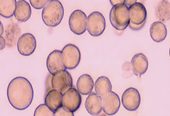 Lonza人原代肝细胞Human Hepatocytes
