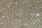 LONZA原代人髂动脉内皮细胞HIAEC和培养基
